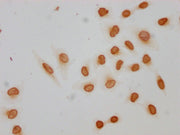 Immunocytochemistry analysis of CSB-PA010389PA09acHU diluted at 1:10 and staining in Hela cells(treated with 30mM sodium butyrate for 4h) performed on a Leica BondTM system. The cells were fixed in 4% formaldehyde, permeabilized using 0.2% Triton...