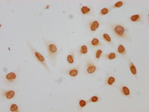 Immunocytochemistry analysis of CSB-PA010389PA09acHU diluted at 1:10 and staining in Hela cells(treated with 30mM sodium butyrate for 4h) performed on a Leica BondTM system. The cells were fixed in 4% formaldehyde, permeabilized using 0.2% Triton...