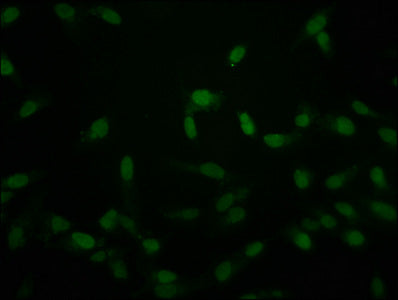 Immunofluorescence staining of Hela cells with CSB-PA010389PA118crHU at 1:50, counter-stained with DAPI. The cells were fixed in 4% formaldehyde, permeabilized using 0.2% Triton X-100 and blocked in 10% normal Goat Serum. The cells were then incub...