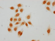 Immunocytochemistry analysis of CSB-PA010389PA15acHU diluted at 1:10 and staining in Hela cells(treated with 30mM sodium butyrate for 4h) performed on a Leica BondTM system. The cells were fixed in 4% formaldehyde, permeabilized using 0.2% Triton...
