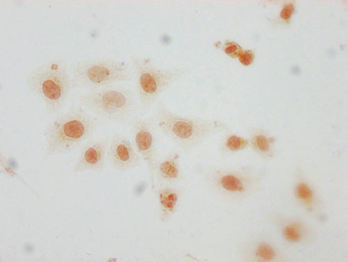 Immunocytochemistry analysis of CSB-PA010389PA29me1HU diluted at 1:10 and staining in Hela cells performed on a Leica BondTM system. The cells were fixed in 4% formaldehyde, permeabilized using 0.2% Triton X-100 and blocked with 10% normal goat se...