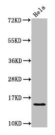 Western Blot Positive WB detected in: Hela whole cell lysate All lanes: HIST1H2AG antibody at 1.25µg/ml Secondary Goat polyclonal to rabbit IgG at 1/50000 dilution Predicted band size: 15 kDa Observed band size: 15 kDa