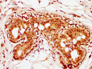 IHC image of CSB-PA010389PA36nhibHU diluted at 1:10 and staining in paraffin-embedded human breast cancer performed on a Leica BondTM system. After dewaxing and hydration, antigen retrieval was mediated by high pressure in a citrate buffer (pH 6.0...