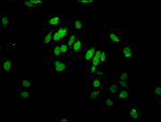 Immunofluorescent analysis of Hela cells (sodium butyrate, 30 mM, 4h) using CSB-PA010389PA95hibHU at dilution of 1:100 and Alexa Fluor 488-congugated AffiniPure Goat Anti-Rabbit IgG(H+L)