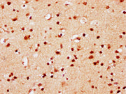 IHC image of CSB-PA010389PA95nsucHU diluted at 1:10 and staining in paraffin-embedded human brain tissue performed on a Leica BondTM system. After dewaxing and hydration, antigen retrieval was mediated by high pressure in a citrate buffer (pH 6.0)...
