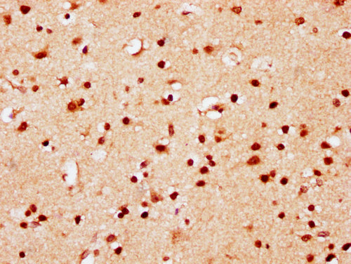 IHC image of CSB-PA010389PA95nsucHU diluted at 1:10 and staining in paraffin-embedded human brain tissue performed on a Leica BondTM system. After dewaxing and hydration, antigen retrieval was mediated by high pressure in a citrate buffer (pH 6.0)...