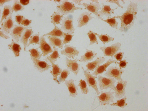 Immunocytochemistry analysis of CSB-PA010389PA95sucHU diluted at 1:10 and staining in Hela cells(treated with 10mM disodium succinylate for 4h) performed on a Leica BondTM system. The cells were fixed in 4% formaldehyde, permeabilized using 0.2% T...