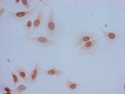 Immunocytochemistry analysis of Hela cells using CSB-PA010402NA05acHU at dilution of 1:100