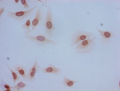 Immunocytochemistry analysis of Hela cells using CSB-PA010402NA05acHU at dilution of 1:100