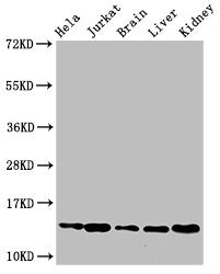 Western Blot Positive WB detected in: Hela cell acid extracts, Jurkat cell acid extracts, Mouse brain tissue, Mouse liver tissue, Mouse kidney tissue All lanes: HIST1H2BB antibody at 2.5µg/ml Secondary Goat polyclonal to rabbit IgG at 1/50000 dilu...