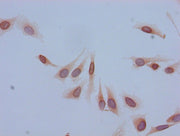Immunocytochemistry analysis of Hela cells using CSB-PA010402PA05acHU at dilution of 1:100