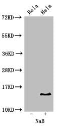 Western Blot Positive WB detected in: Hela cell acid extracts treated by NaB All lanes: HIST1H2BB antibody at 2µg/ml Secondary Goat polyclonal to rabbit IgG at 1/50000 dilution Predicted band size: 14 kDa Observed band size: 14 kDa