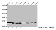 Western Blot Detected samples: Hela whole cell lysate, 293 whole cell lysate, A549 whole cell lysate, HepG2 whole cell lysate; Untreated (-) or treated (+) with 30mM sodium butyrate for 4h All lanes: HIST1H2BC antibody at 1:100 Secondary Goat poly...