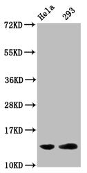 Western Blot Positive WB detected in: Hela whole cell lysate, 293 whole cell lysate (all treated with 30mM sodium butyrate for 4h) All lanes: HIST1H2BC antibody at 1.7µg/ml Secondary Goat polyclonal to rabbit IgG at 1/50000 dilution Predicted band...