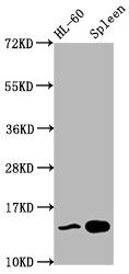 Western Blot Positive WB detected in: HL60 whole cell lysate, Rat spleen tissue All lanes: HIST1H2BC antibody at 0.45µg/ml Secondary Goat polyclonal to rabbit IgG at 1/50000 dilution Predicted band size: 14 kDa Observed band size: 14 kDa