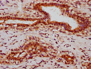 IHC image of CSB-PA010403OA05ngluHU diluted at 1:10 and staining in paraffin-embedded human breast cancer performed on a Leica BondTM system. After dewaxing and hydration, antigen retrieval was mediated by high pressure in a citrate buffer (pH 6.0...