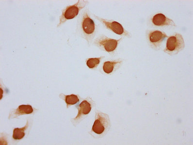 Immunocytochemistry analysis of CSB-PA010403OA108acHU diluted at 1:5 and staining in Hela cells (treated with 30mM sodium butyrate for 4h) performed on a Leica BondTM system. The cells were fixed in 4% formaldehyde, permeabilized using 0.2% Triton...