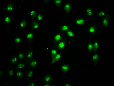 Immunofluorescence staining of Hela cells with CSB-PA010403OA108nacHU at 1:2.5, counter-stained with DAPI. The cells were fixed in 4% formaldehyde, permeabilized using 0.2% Triton X-100 and blocked in 10% normal Goat Serum. The cells were then inc...