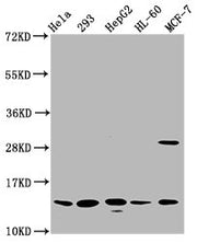 Western Blot Positive WB detected in: Hela whole cell lysate, 293 whole cell lysate, HepG2 whole cell lysate, HL60 whole cell lysate, MCF-7 whole cell lysate All lanes: HIST1H2BC antibody at 0.79µg/ml Secondary Goat polyclonal to rabbit IgG at 1/5...
