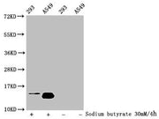 Western Blot Detected samples: 293 whole cell lysate, A549 whole cell lysate; Untreated (-) or treated (+) with 30mM sodium butyrate for 4h All lanes: HIST1H2BC antibody at 1:100 Secondary Goat polyclonal to rabbit IgG at 1/50000 dilution Predicte...
