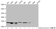 Western Blot Detected samples: 293 whole cell lysate, A549 whole cell lysate, K562 whole cell lysate, Jurkat whole cell lysate; Untreated (-) or treated (+) with 30mM sodium butyrate for 4h All lanes: HIST1H2BC antibody at 1:100 Secondary Goat pol...