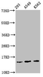 Western Blot Positive WB detected in: 293 whole cell lysate, A549 whole cell lysate, K562 whole cell lysate All lanes: HIST1H2BC antibody at 1.1µg/ml Secondary Goat polyclonal to rabbit IgG at 1/50000 dilution Predicted band size: 14 kDa Observed...