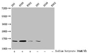 Western Blot Detected samples: 293 whole cell lysate, A549 whole cell lysate, K562 whole cell lysate; Untreated (-) or treated (+) with 30mM sodium butyrate for 4h All lanes: HIST1H2BC antibody at 1:100 Secondary Goat polyclonal to rabbit IgG at 1...