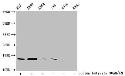 Western Blot Detected samples: 293 whole cell lysate, A549 whole cell lysate, K562 whole cell lysate; Untreated (-) or treated (+) with 30mM sodium butyrate for 4h All lanes: HIST1H2BC antibody at 1:100 Secondary Goat polyclonal to rabbit IgG at 1...