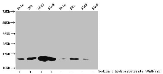 Western Blot Detected samples: Hela whole cell lysate, 293 whole cell lysate, A549 whole cell lysate, K562 whole cell lysate; Untreated (-) or treated (+) with 50mM Sodium 3-hydroxybutyrate for 72h All lanes: HIST1H2BC antibody at 1:100 Secondary...