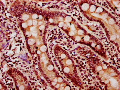 IHC image of CSB-PA010403OA11nacHU diluted at 1:20 and staining in paraffin-embedded human small intestine tissue performed on a Leica BondTM system. After dewaxing and hydration, antigen retrieval was mediated by high pressure in a citrate buffer...