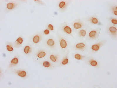 Immunocytochemistry analysis of CSB-PA010403OA120acHU diluted at 1:5 and staining in Hela cells (treated with 30mM sodium butyrate for 4h) performed on a Leica BondTM system. The cells were fixed in 4% formaldehyde, permeabilized using 0.2% Triton...