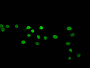 Immunofluorescence staining of Hela cells (treated with 50mM sodium 3-hydroxybutyrate for 72h) with CSB-PA010403OA120bhbHU at 1:10, counter-stained with DAPI. The cells were fixed in 4% formaldehyde, permeabilized using 0.2% Triton X-100 and block...