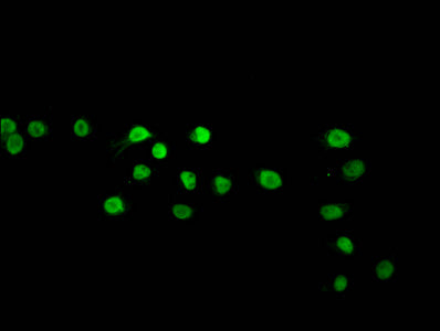Immunofluorescence staining of Hela cells (treated with 50mM sodium 3-hydroxybutyrate for 72h) with CSB-PA010403OA120bhbHU at 1:10, counter-stained with DAPI. The cells were fixed in 4% formaldehyde, permeabilized using 0.2% Triton X-100 and block...