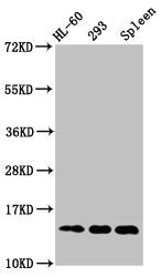 Western Blot Positive WB detected in: HL60 whole cell lysate, 293 whole cell lysate, Rat spleen tissue All lanes: HIST1H2BC antibody at 1µg/ml Secondary Goat polyclonal to rabbit IgG at 1/50000 dilution Predicted band size: 14 kDa Observed band si...