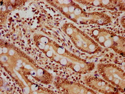 IHC image of CSB-PA010403OA120ngluHU diluted at 1:20 and staining in paraffin-embedded human small intestine tissue performed on a Leica BondTM system. After dewaxing and hydration, antigen retrieval was mediated by high pressure in a citrate buff...