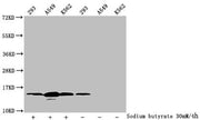 Western Blot Detected samples: 293 whole cell lysate, A549 whole cell lysate, K562 whole cell lysate; Untreated (-) or treated (+) with 30mM sodium butyrate for 4h All lanes: HIST1H2BC antibody at 1:100 Secondary Goat polyclonal to rabbit IgG at 1...