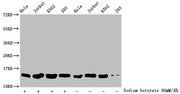 Western Blot Detected samples: Hela whole cell lysate, Jurkat whole cell lysate, K562 whole cell lysate, 293 whole cell lysate; Untreated (-) or treated (+) with 30mM sodium butyrate for 4h All lanes: HIST1H2BC antibody at 1:500 Secondary Goat pol...
