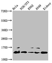Western Blot Positive WB detected in: Hela whole cell lysate, NIH/3T3 whole cell lysate, K562 whole cell lysate, A549 whole cell lysate, Rat kidney tissue All lanes: HIST1H2BC antibody at 0.9µg/ml Secondary Goat polyclonal to rabbit IgG at 1/50000...