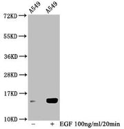Western Blot Detected samples: A549 whole cell lysate; Untreated (-) or treated (+) with 100ng/ml EGF for 20min All lanes: HIST1H2BC antibody at 1:100 Secondary Goat polyclonal to rabbit IgG at 1/50000 dilution Predicted band size: 14 kDa Observed...