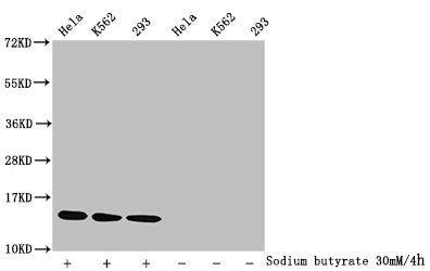 Western Blot Detected samples: Hela whole cell lysate, K562 whole cell lysate, 293 whole cell lysate; Untreated (-) or treated (+) with 30mM sodium butyrate for 4h All lanes: HIST1H2BC antibody at 1:1000 Secondary Goat polyclonal to rabbit IgG at...