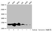 Western Blot Detected samples: 293 whole cell lysate, A549 whole cell lysate, K562 whole cell lysate; Untreated (-) or treated (+) with 30mM sodium butyrate for 4h All lanes: HIST1H2BC antibody at 1:100 Secondary Goat polyclonal to rabbit IgG at 1...