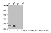 Western Blot Detected samples: 293 whole cell lysate, A549 whole cell lysate; Untreated (-) or treated (+) with 50mM Sodium 3-hydroxybutyrate for 72h All lanes: HIST1H2BC antibody at 1:100 Secondary Goat polyclonal to rabbit IgG at 1/50000 dilutio...