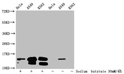 Western Blot Detected samples: Hela whole cell lysate, A549 whole cell lysate, K562 whole cell lysate; Untreated (-) or treated (+) with 30mM sodium butyrate for 4h All lanes: HIST1H2BC antibody at 1:100 Secondary Goat polyclonal to rabbit IgG at...
