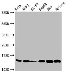 Western Blot Positive WB detected in: Hela whole cell lysate, K562 whole cell lysate, HL60 whole cell lysate, HepG2 whole cell lysate, 293 whole cell lysate, Rat spleen tissue All lanes: HIST1H2BC antibody at 0.33µg/ml Secondary Goat polyclonal to...