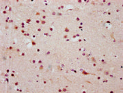 IHC image of CSB-PA010403OA20ncrHU diluted at 1:20 and staining in paraffin-embedded human brain tissue performed on a Leica BondTM system. After dewaxing and hydration, antigen retrieval was mediated by high pressure in a citrate buffer (pH 6.0)....