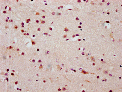 IHC image of CSB-PA010403OA20ncrHU diluted at 1:20 and staining in paraffin-embedded human brain tissue performed on a Leica BondTM system. After dewaxing and hydration, antigen retrieval was mediated by high pressure in a citrate buffer (pH 6.0)....