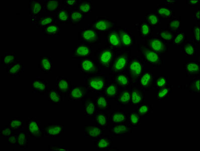 Immunofluorescence staining of Hela cells (treated with 30mM sodium crotonylate for 4h) with CSB-PA010403OA23crHU at 1:37.5, counter-stained with DAPI. The cells were fixed in 4% formaldehyde, permeabilized using 0.2% Triton X-100 and blocked in 1...