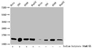 Western Blot Detected samples: Hela whole cell lysate, 293 whole cell lysate, A549 whole cell lysate, HepG2 whole cell lysate; Untreated (-) or treated (+) with 30mM sodium butyrate for 4h All lanes: HIST1H2BC antibody at 1:100 Secondary Goat poly...