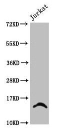 Western Blot Positive WB detected in: Jurkat whole cell lysate (treated with 30mM sodium butyrate for 4h) All lanes: HIST1H2BC antibody at 2.4µg/ml Secondary Goat polyclonal to rabbit IgG at 1/50000 dilution Predicted band size: 14 kDa Observed ba...