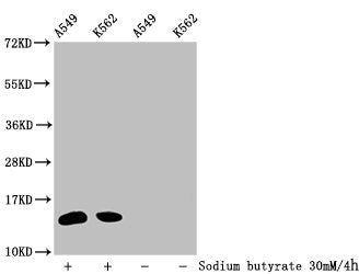 Western Blot Detected samples: A549 whole cell lysate, K562 whole cell lysate; Untreated (-) or treated (+) with 30mM sodium butyrate for 4h All lanes: HIST1H2BC antibody at 1:100 Secondary Goat polyclonal to rabbit IgG at 1/50000 dilution Predict...